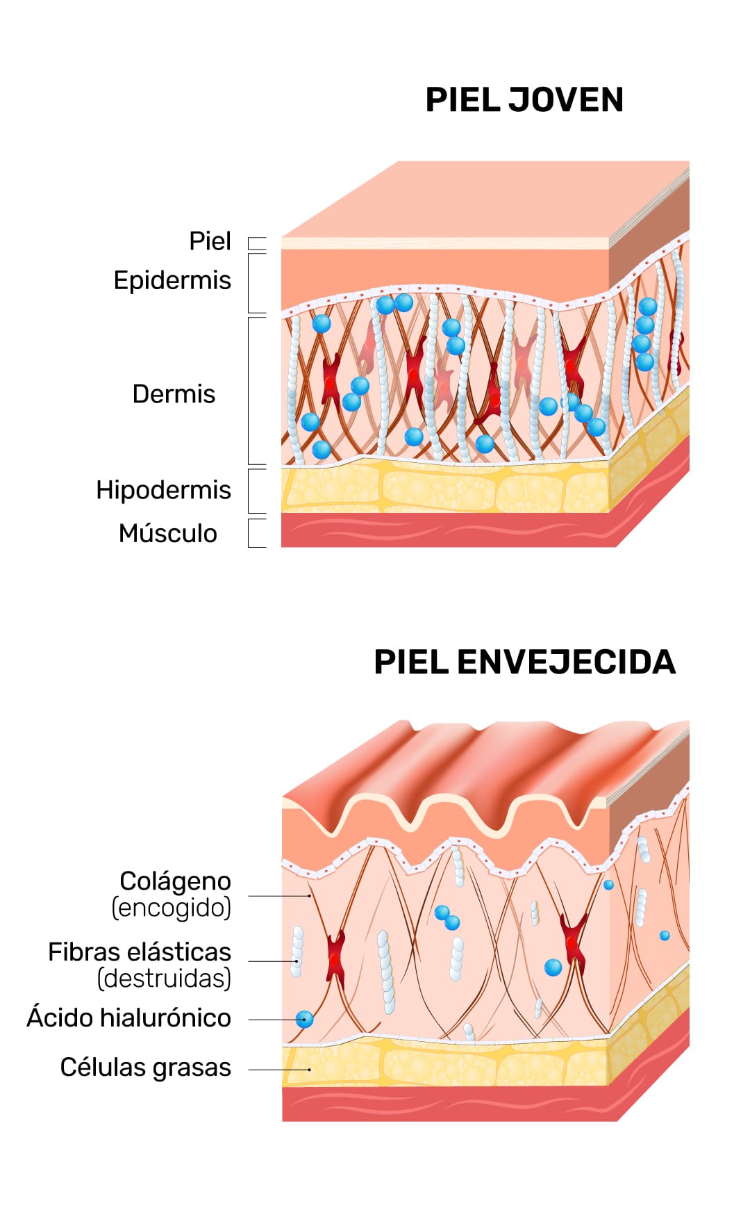 Comparación de piel joven y piel envejecida con sus capas y sus fibras de colágeno