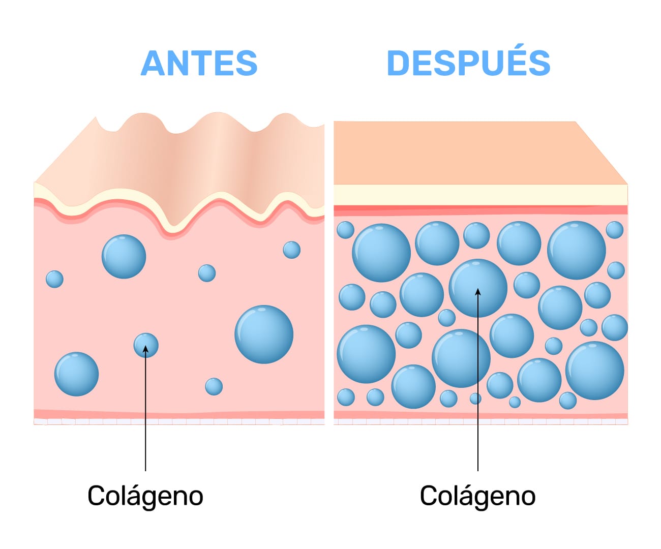 Piel antes y después: comparación de la cantidad de colágeno en el tejido